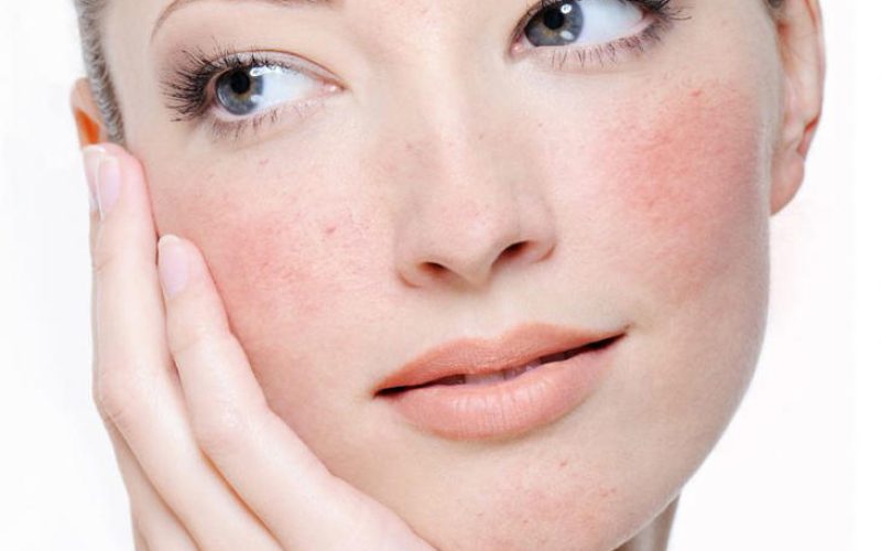Sensitive Skin? Discover Which Ingredients to Avoid and Which Ones Calm.